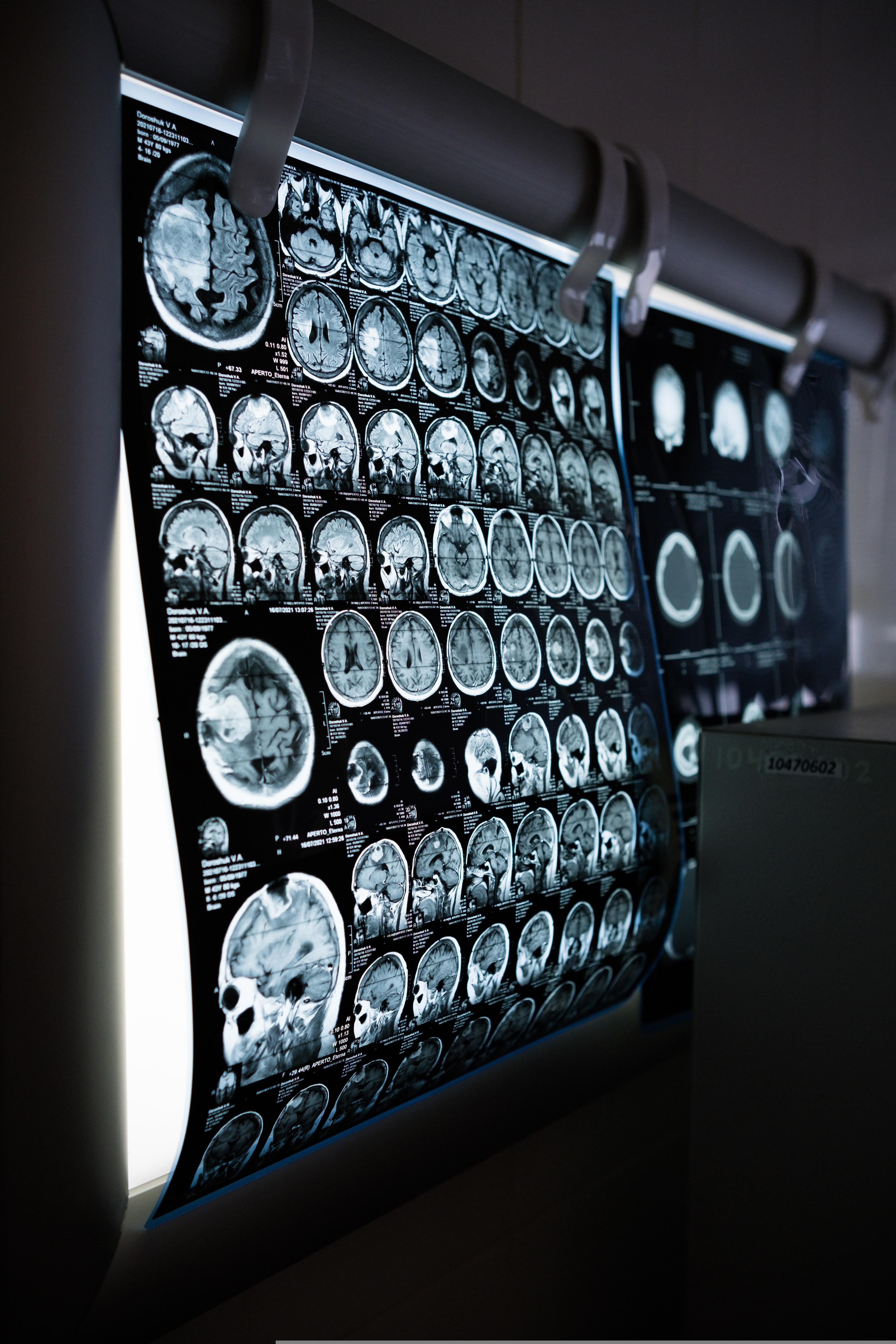 Whole-Body CT in Major Trauma